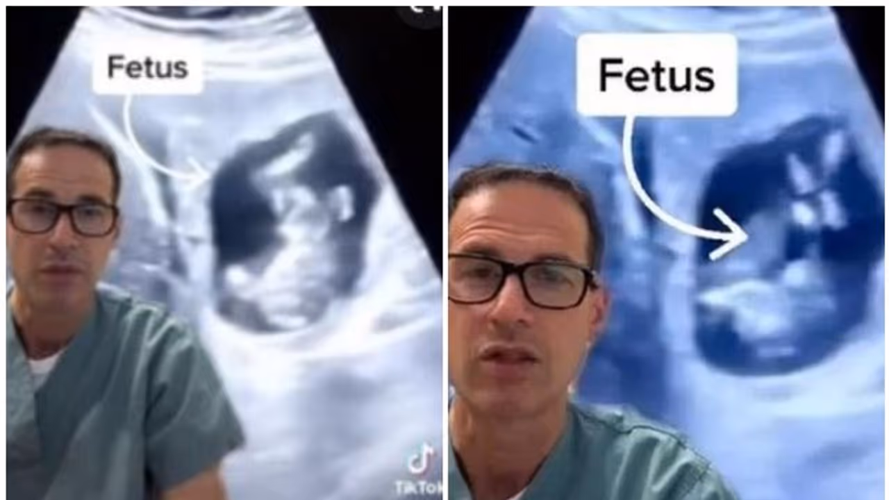 Ectopic Pregnancy : യുവതിയുടെ കരളിനുള്ളില്‍ ഭ്രൂണം വളരുന്നതായി കണ്ടെത്തി; അപൂർവങ്ങളിൽ അപൂർവമെന്ന് ഡോക്ടർമാർ