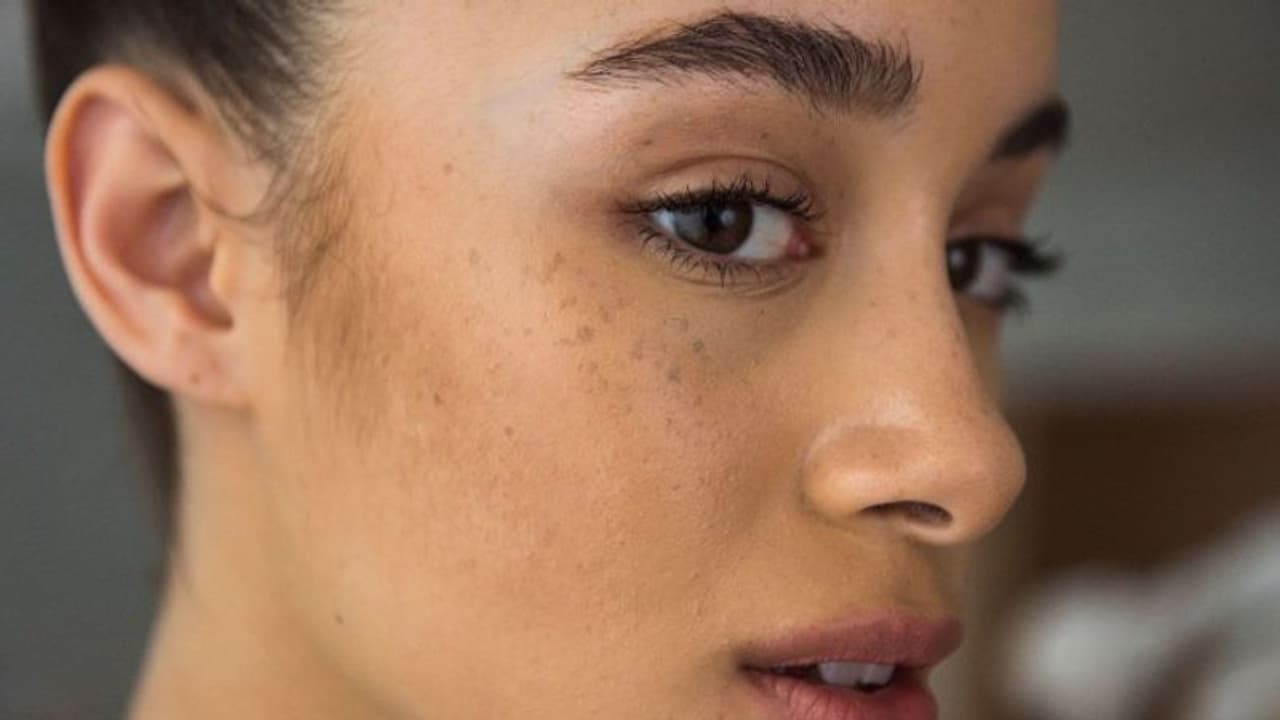 Skin Care : മുഖത്തെ കറുത്ത പാടുകള് മാറ്റാം; വീട്ടില് പരീക്ഷിക്കാം ഇക്കാര്യങ്ങള്... Skin Care : മുഖത്തെ കറുത്ത പാടുകള് മാറ്റാം; വീട്ടില് പരീക്ഷിക്കാം ഇക്കാര്യങ്ങള്...