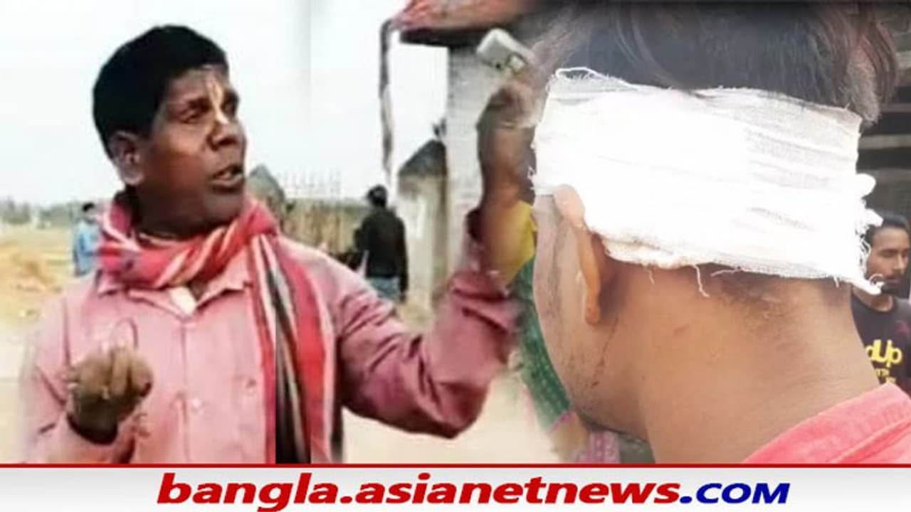 Kacha Badam Song: কাঁচা বাদাম গেয়ে উত্ত্যক্ত করার অভিযোগ, মাথা ফাটল লিলুয়ার যুবকের Kacha Badam Song: কাঁচা বাদাম গেয়ে উত্ত্যক্ত করার অভিযোগ, মাথা ফাটল লিলুয়ার যুবকের