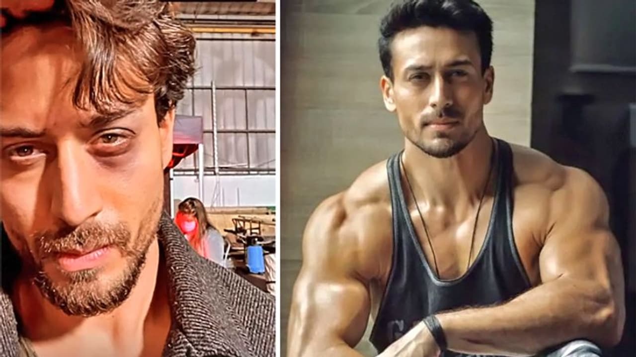 सूजी आंख, बिखरे बाल और चेहरे पर थकान, Tiger Shroff को इस हाल में देख सेहत को लेकर सवाल पूछने लगे फैंस सूजी आंख, बिखरे बाल और चेहरे पर थकान, Tiger Shroff को इस हाल में देख सेहत को लेकर सवाल पूछने लगे फैंस
