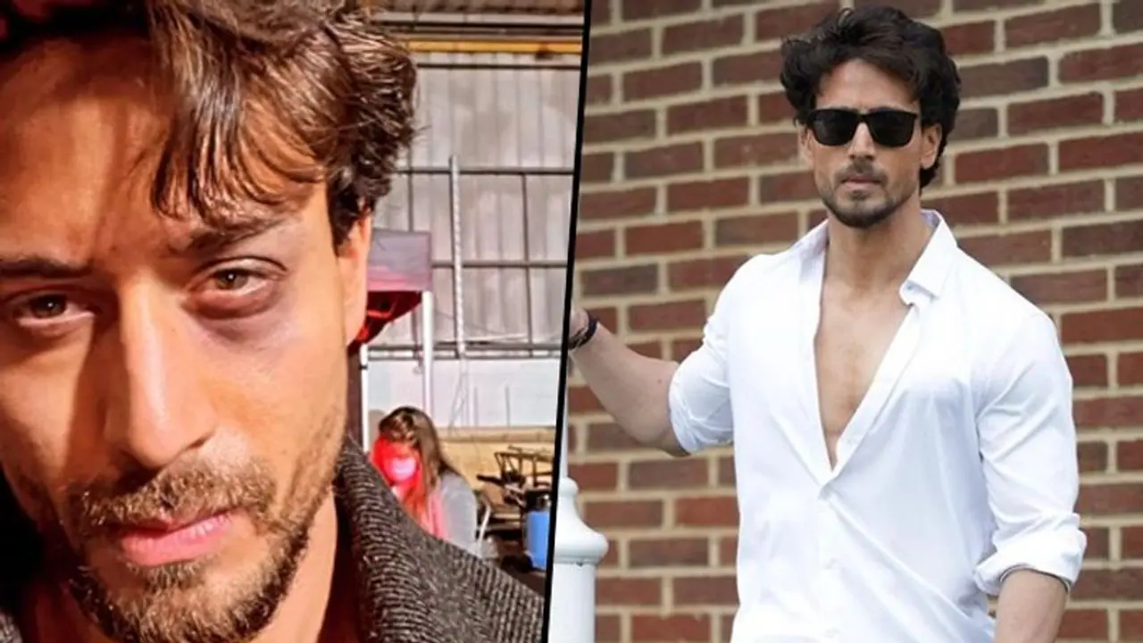 Tiger Shroff suffers eye injury, read complete details inside