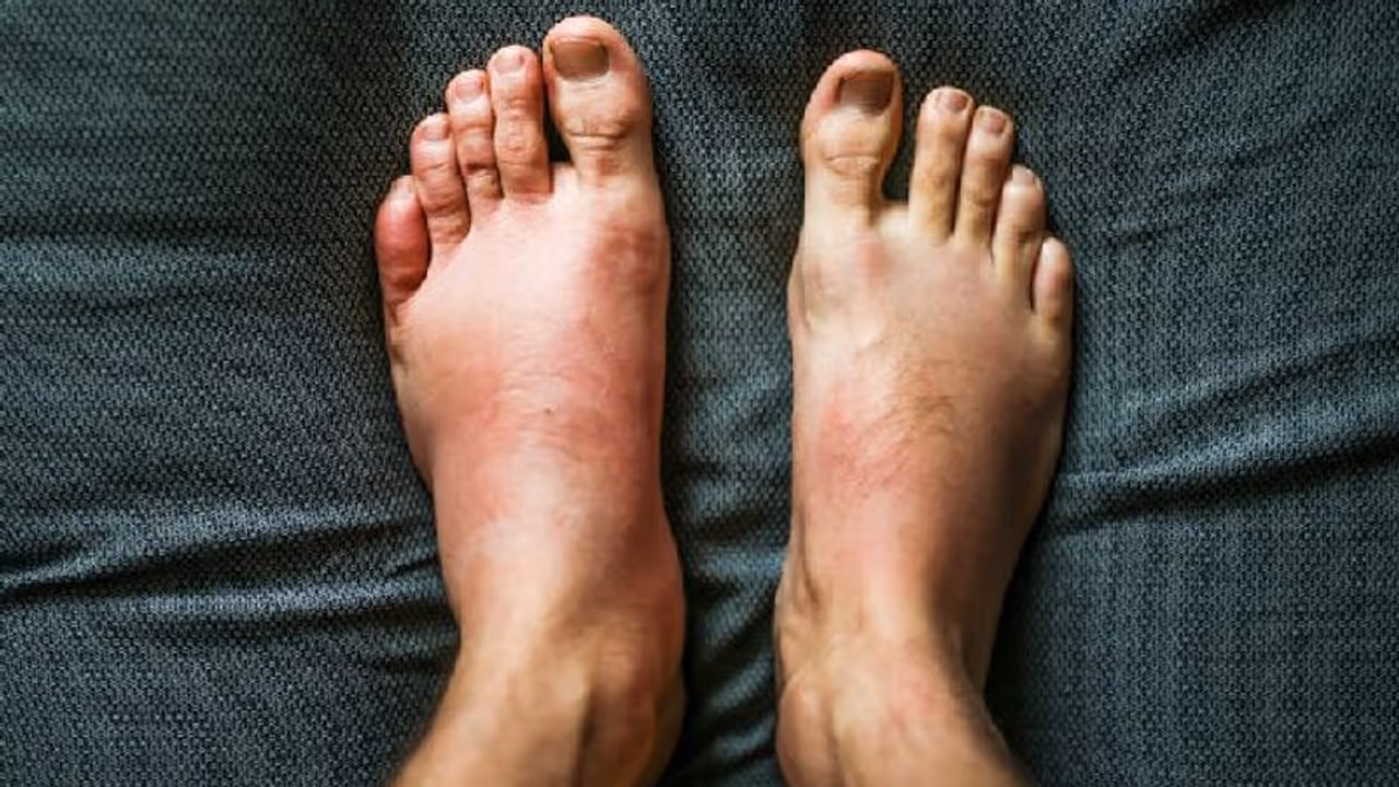 கர்ப்ப காலத்தில் கால் வீக்கத்திற்கு என்ன காரணம்? வீக்கத்தை குறைக்க பெஸ்ட் வழிகள் இதோ..!