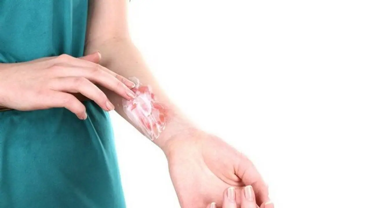 রান্নাঘরে কাজ করতে গিয়ে যদি হাত পুড়ে যায়, তাহলে ভুল করেও এই ভুলগুলি করবেন না