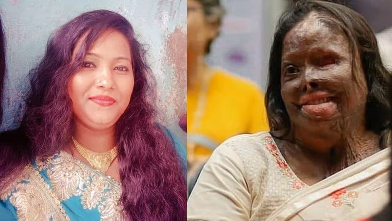 Acid Attack: പ്രേതം പോലുണ്ട്, ആസിഡ് വീണ മുഖം നോക്കി മക്കള്‍ പോലും അവളെ വിളിച്ചു!