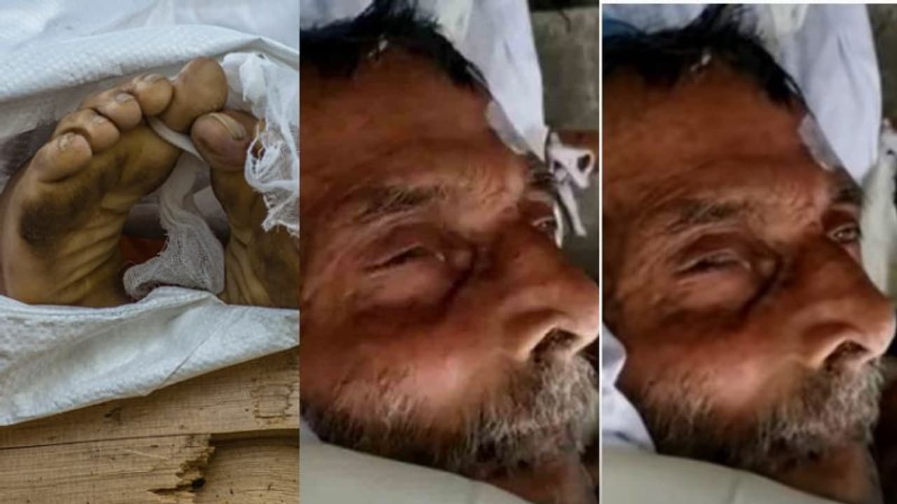 മരിച്ചെന്ന് കരുതി ചിതയിലേക്ക് എടുത്തു; കണ്ണ് ചിമ്മി ജീവിതത്തിലേക്ക് തിരിച്ച് വന്ന് 62കാരന് മരിച്ചെന്ന് കരുതി ചിതയിലേക്ക് എടുത്തു; കണ്ണ് ചിമ്മി ജീവിതത്തിലേക്ക് തിരിച്ച് വന്ന് 62കാരന്