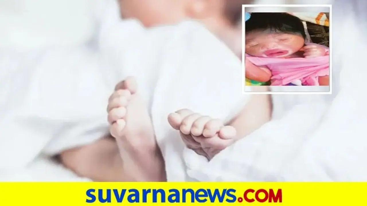 Plastic Baby: ಬಿಹಾರದಲ್ಲಿ ವಿಶೇಷ ಮಗು ಜನಿಸಿದ್ದಕ್ಕೆ ಕಾರಣ ಹೇಳಿದ ವೈದ್ಯರು!