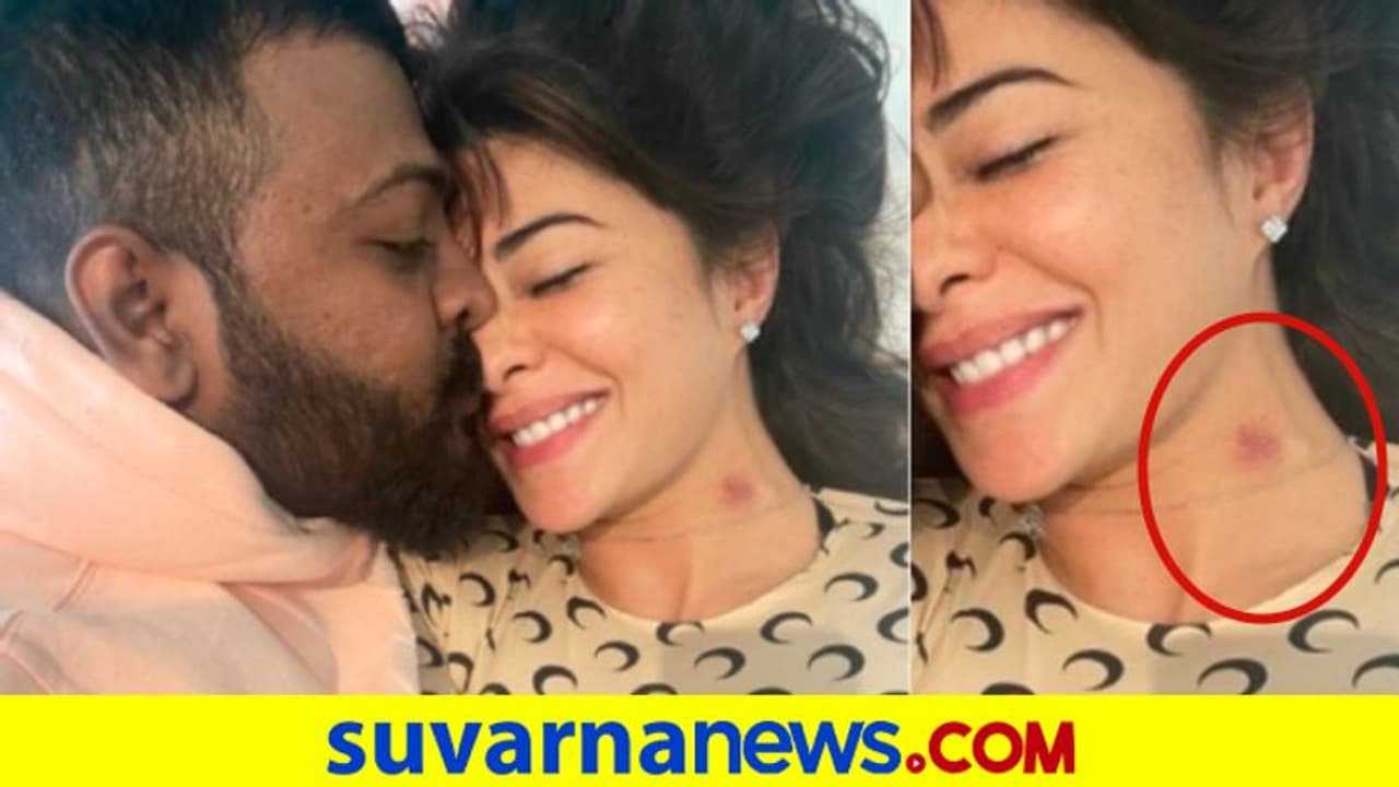 Jacqueline Fernandez Love Bite: ಆರೋಪಿ ಜೊತೆ ರೊಮ್ಯಾನ್ಸ್, ಜಾಕಿ ಕುತ್ತಿಗೆಯಲ್ಲಿ ಲವ್ ಬೈಟ್ Jacqueline Fernandez Love Bite: ಆರೋಪಿ ಜೊತೆ ರೊಮ್ಯಾನ್ಸ್, ಜಾಕಿ ಕುತ್ತಿಗೆಯಲ್ಲಿ ಲವ್ ಬೈಟ್
