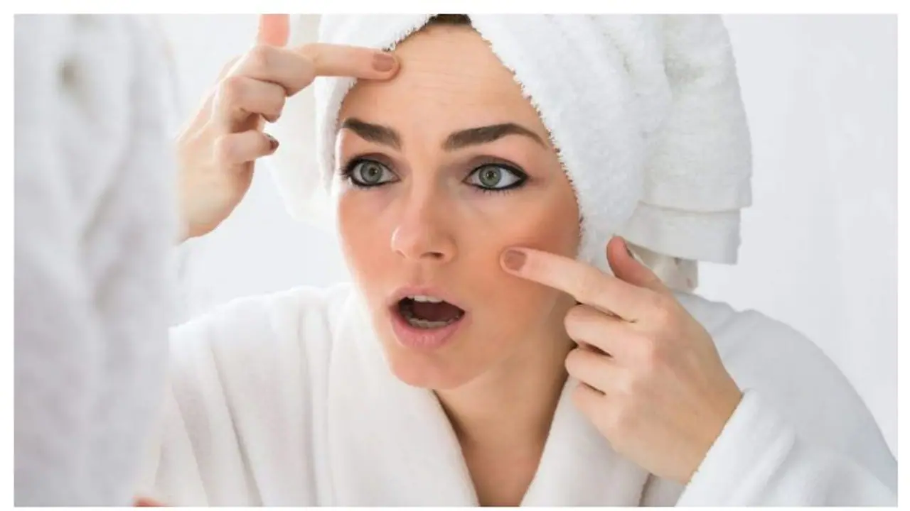 গরম পড়তেই মুখে ব্রণ তে ভরে গেছে, ঘরোয়া টোটকায় দূরল করুন কালো দাগ ছোপ গরম পড়তেই মুখে ব্রণ তে ভরে গেছে, ঘরোয়া টোটকায় দূরল করুন কালো দাগ ছোপ