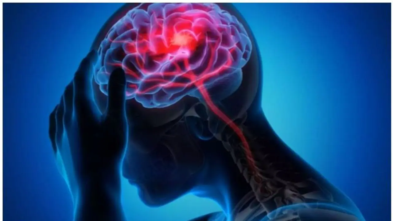 Brain Stroke : മസ്തിഷ്കാഘാതം പ്രതിരോധിക്കാൻ ഇക്കാര്യങ്ങൾ ശ്രദ്ധിക്കാം Brain Stroke : മസ്തിഷ്കാഘാതം പ്രതിരോധിക്കാൻ ഇക്കാര്യങ്ങൾ ശ്രദ്ധിക്കാം