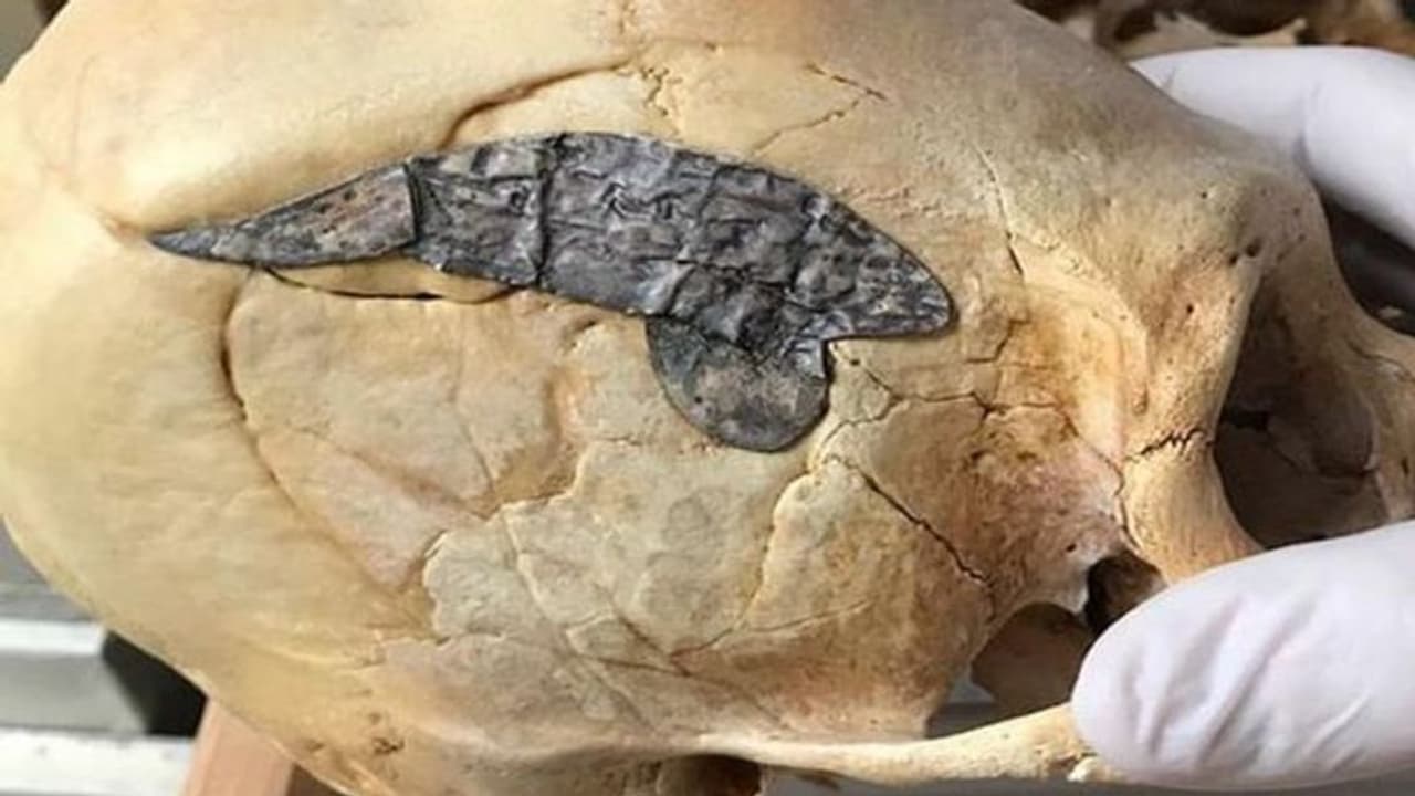 जांच में मिली 2000 साल पुरानी मानव खोपड़ी, उसमें लगी चीज देखकर विशेषज्ञ भी हैरान जांच में मिली 2000 साल पुरानी मानव खोपड़ी, उसमें लगी चीज देखकर विशेषज्ञ भी हैरान