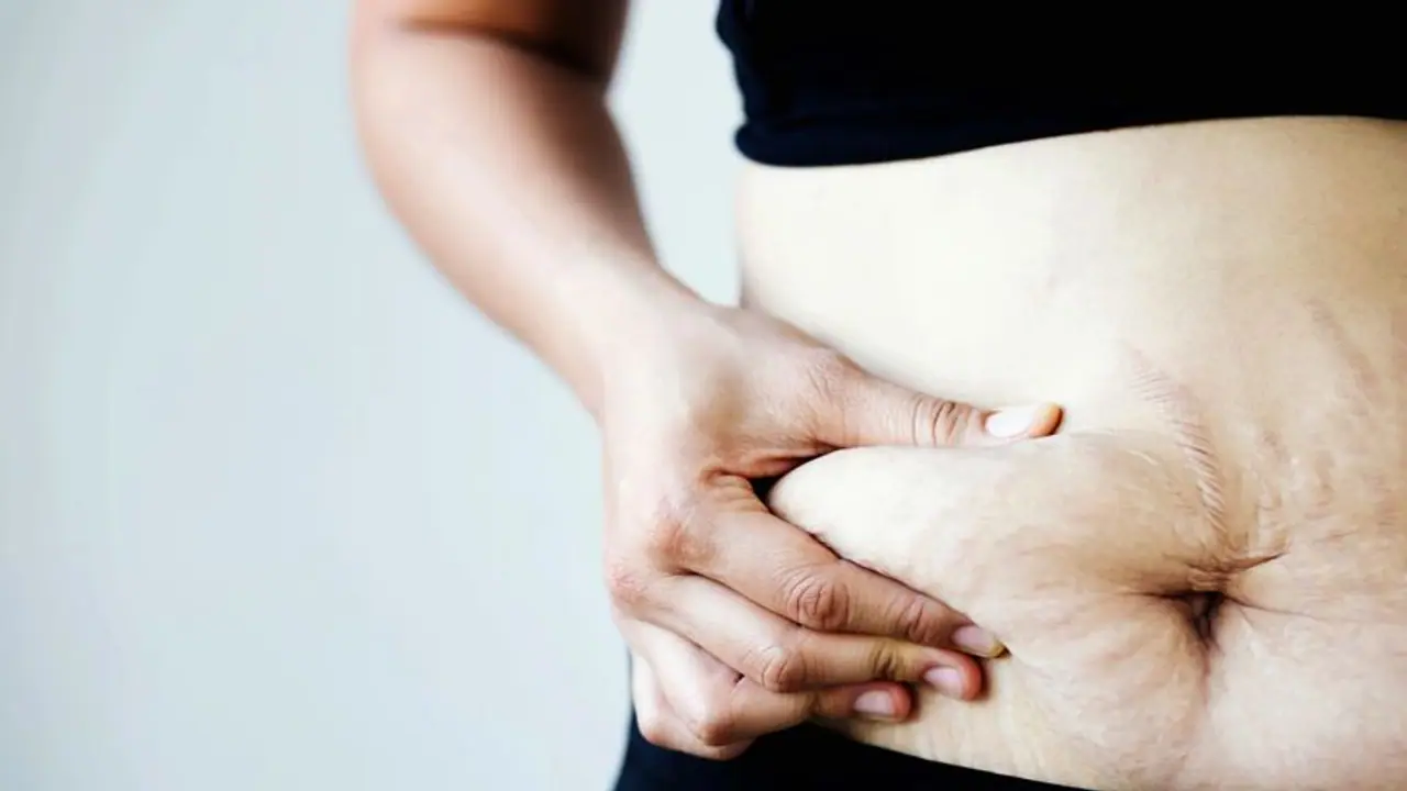 Shea Butter for Stretch Marks: স্ট্রেচ মার্ক দূর করতে কাজে লাগান অব্যর্থ এই টোটকা Shea Butter for Stretch Marks: স্ট্রেচ মার্ক দূর করতে কাজে লাগান অব্যর্থ এই টোটকা