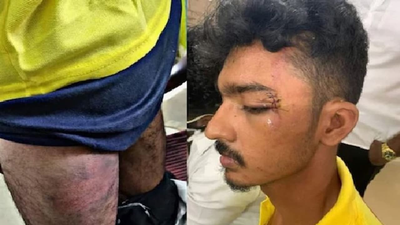 சட்டக்கல்லூரி மாணவன் கொடூர தாக்குதல்.. விடிய விடிய வைத்து அடித்ததாக புகார்..போலீஸ் மீது பாய்ந்தது வழக்கு..