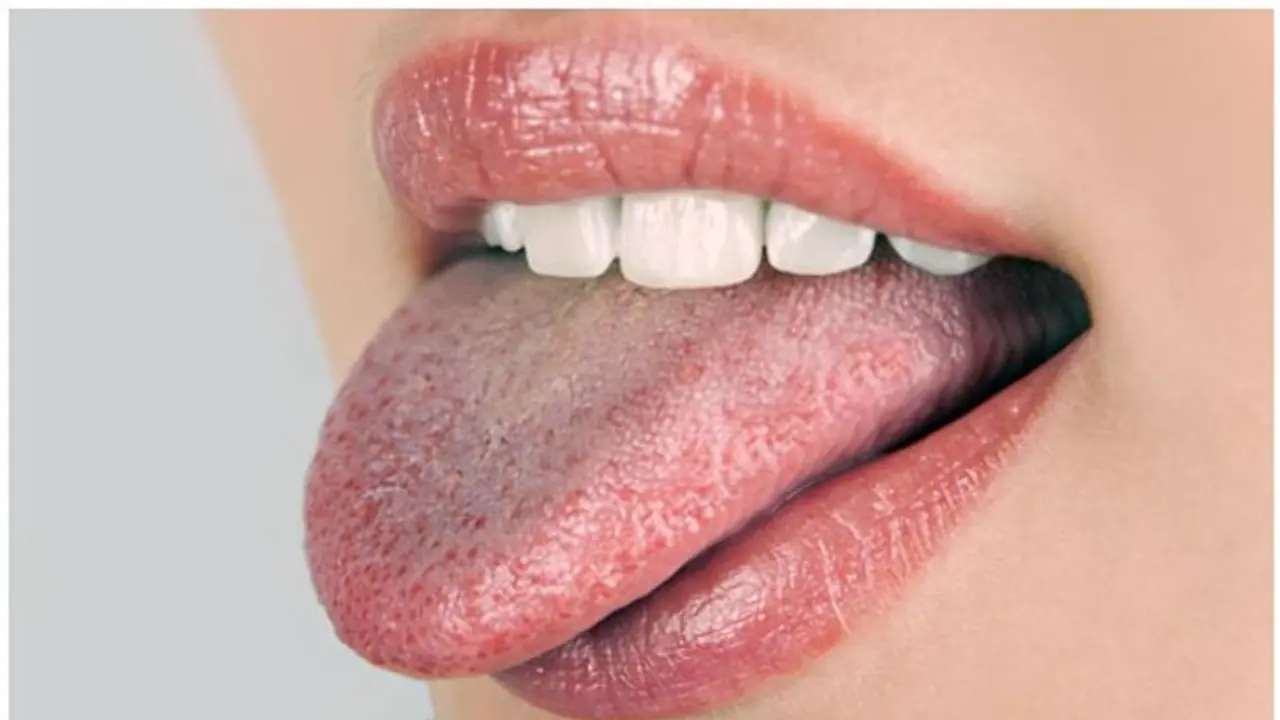  నాలుక తెల్లగా ఉంటే ఎన్నో రోగాలొస్తయ్.. అందుకే ఇలా చేయండి? 