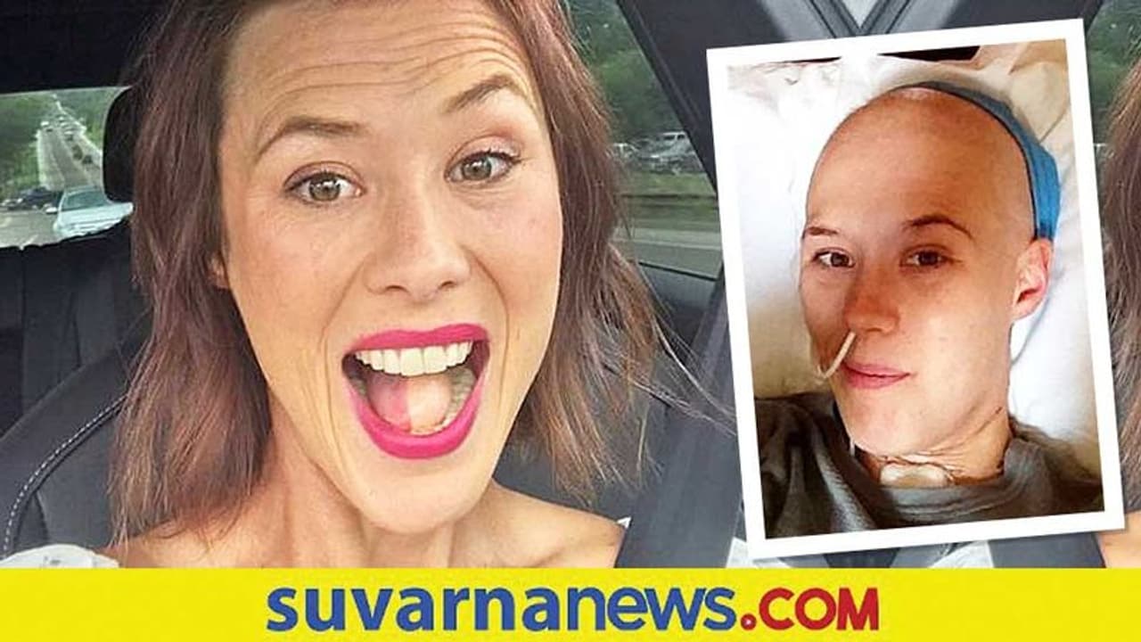 ಕ್ಯಾನ್ಸರ್‌ನಿಂದ ಬಳಲುತ್ತಿದ್ದ ಮಹಿಳೆಗೆ ಈಗ ಹೊಸ ಸಮಸ್ಯೆ... ನಾಲಿಗೆಯಲ್ಲಿ ಬೆಳೆತಿದೆ ಕೂದಲು