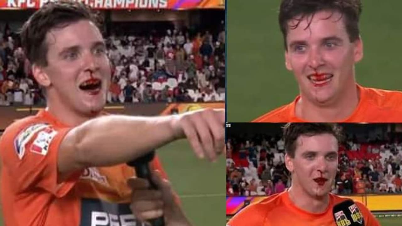 BBL: ஆஸி., வீரரின் மூக்கை உடைத்த காலின் முன்ரோ! வடியும் ரத்தத்தையும் பொருட்படுத்தாத வெற்றி கொண்டாட்டம்! வீடியோ BBL: ஆஸி., வீரரின் மூக்கை உடைத்த காலின் முன்ரோ! வடியும் ரத்தத்தையும் பொருட்படுத்தாத வெற்றி கொண்டாட்டம்! வீடியோ