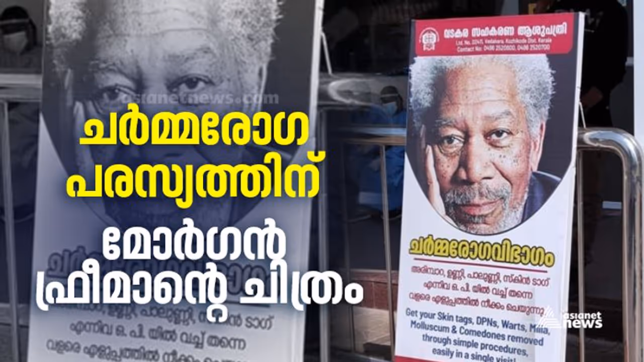 അരിമ്പാറ, പാലുണ്ണി ചികിത്സയ്ക്ക് മോര്ഗന് ഫ്രീമാന്റെ ചിത്രം; വടകര സഹകരണ ആശുപത്രി പരസ്യത്തിന് രൂക്ഷ പരിഹാസം അരിമ്പാറ, പാലുണ്ണി ചികിത്സയ്ക്ക് മോര്ഗന് ഫ്രീമാന്റെ ചിത്രം; വടകര സഹകരണ ആശുപത്രി പരസ്യത്തിന് രൂക്ഷ പരിഹാസം