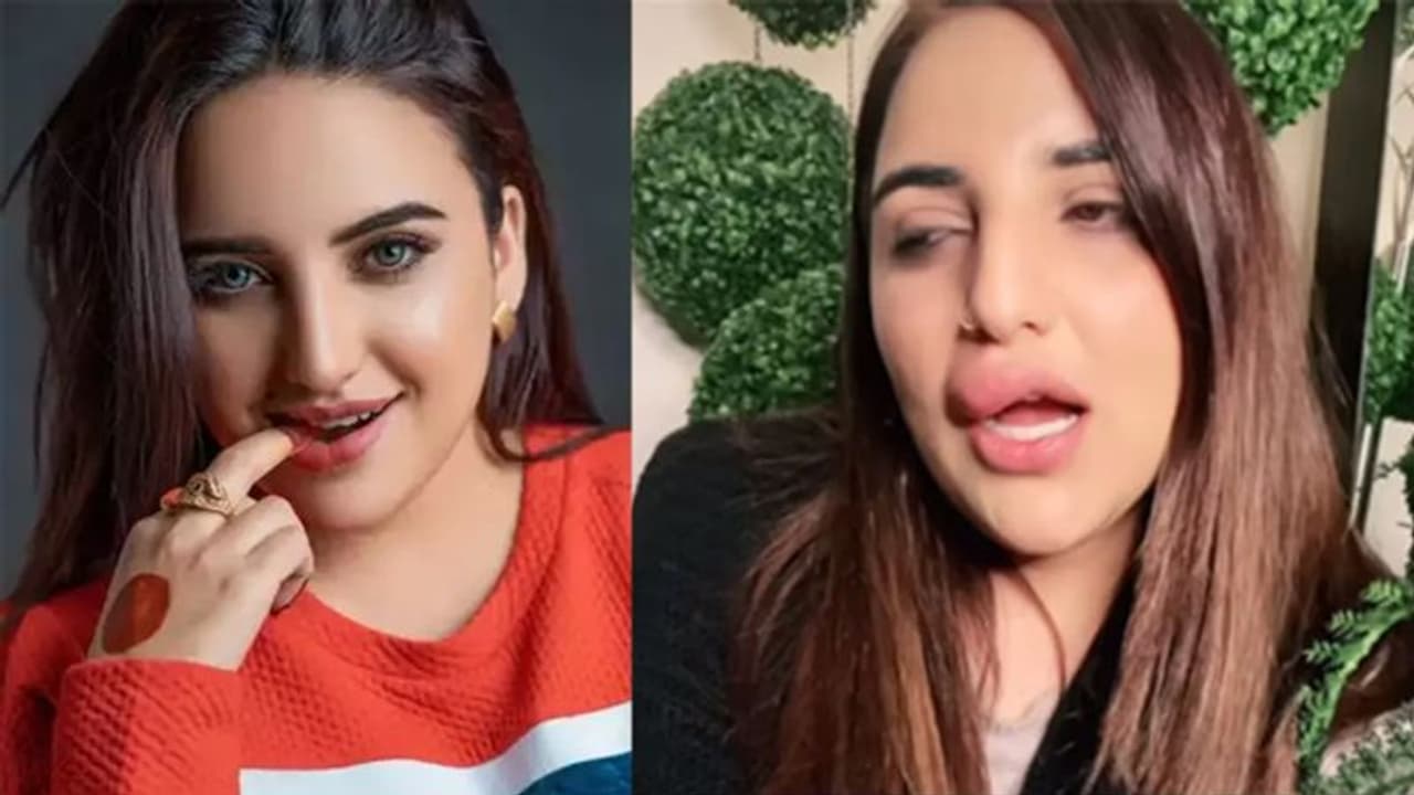 सूजे हुए होंठ के साथ छलका पाकिस्तानी टिकटॉकर Hareem Shah का दर्द, आपबीती सुनाते हुए कही ये बात