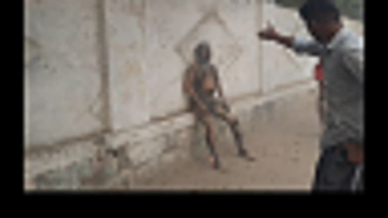 அசிங்கப்படுத்திய நிதி நிறுவனம்.. நடுரோட்டில் தீக்குளித்த கடனாளி.. திருச்சியில் அதிர்ச்சி...