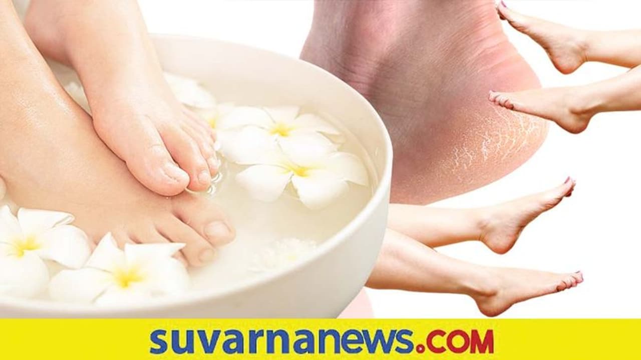 Cracked Heel: ಬಿರುಕು ಬಿಟ್ಟ ಹಿಮ್ಮಡಿಗೆ ಮನೆಯಲ್ಲೇ ಇದೆ ಪರಿಹಾರ Cracked Heel: ಬಿರುಕು ಬಿಟ್ಟ ಹಿಮ್ಮಡಿಗೆ ಮನೆಯಲ್ಲೇ ಇದೆ ಪರಿಹಾರ