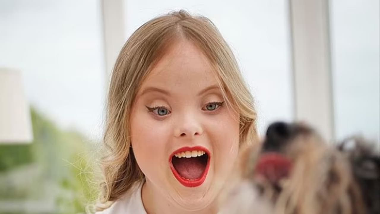 Beth Matthews : ഡൗണ്സ് സിന്ഡ്രോം തോറ്റു, ഗ്ലാമര് ലോകത്ത് താരമായി ഈ യുവതി! Beth Matthews : ഡൗണ്സ് സിന്ഡ്രോം തോറ്റു, ഗ്ലാമര് ലോകത്ത് താരമായി ഈ യുവതി!