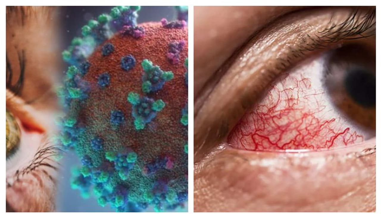 Omicron new symptoms: கண்களை குறிவைத்து தாக்கும் ஒமிக்ரான்...இனி இந்த அறிகுறிகள் இருந்தால் அலெர்ட்டா இருங்கோ!! Omicron new symptoms: கண்களை குறிவைத்து தாக்கும் ஒமிக்ரான்...இனி இந்த அறிகுறிகள் இருந்தால் அலெர்ட்டா இருங்கோ!!