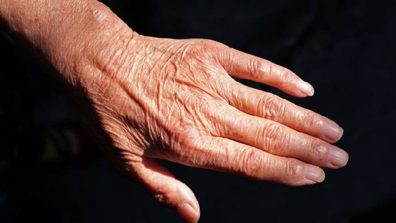 'കൊച്ചുമക്കൾ എന്നെ കാണുമ്പോൾ ഭയപ്പെടരുതേ എന്നതാണ് ഏറ്റവും വലിയ പ്രാർത്ഥന', ഒരു കുഷ്ഠരോഗിയുടെ ജീവിതം 'കൊച്ചുമക്കൾ എന്നെ കാണുമ്പോൾ ഭയപ്പെടരുതേ എന്നതാണ് ഏറ്റവും വലിയ പ്രാർത്ഥന', ഒരു കുഷ്ഠരോഗിയുടെ ജീവിതം