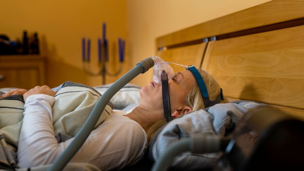 obstructive sleep apnea