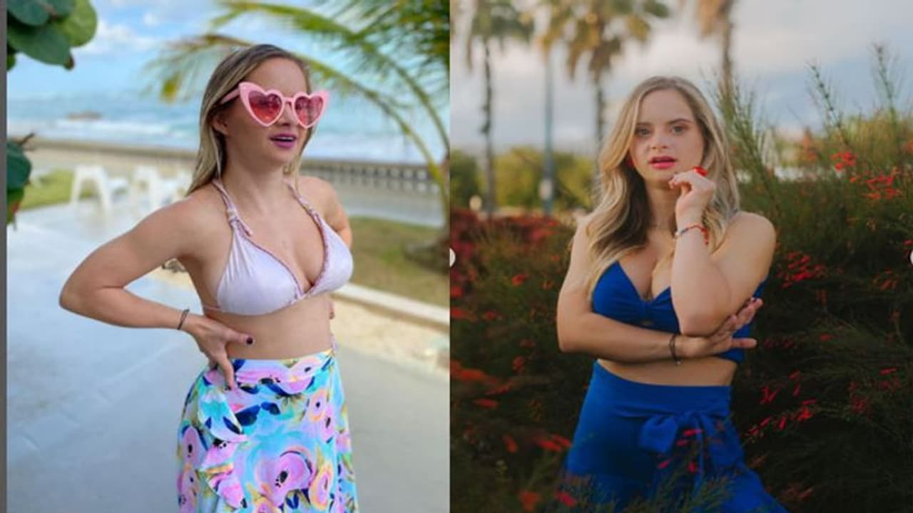 Sofia Jirau विक्टोरिया सीक्रेट की Model बन रचा इतिहास, पुर्तगाली मॉडल इस बीमारी से हैं पीड़ित