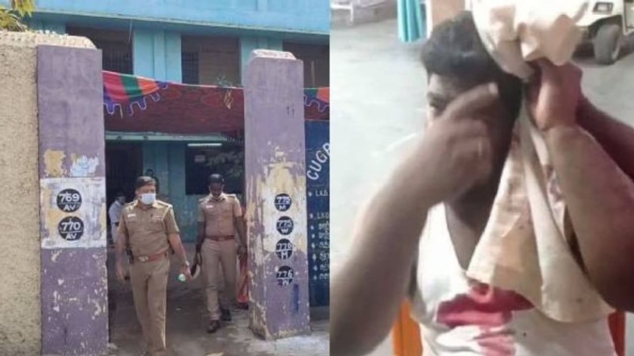 திமுக அதிமுகவினர் இடையே தகராறு... கல்லால் தாக்குதல்... ரத்தம் சொட்ட சொட்ட மருத்துவமனையில் அனுமதி!! திமுக அதிமுகவினர் இடையே தகராறு... கல்லால் தாக்குதல்... ரத்தம் சொட்ட சொட்ட மருத்துவமனையில் அனுமதி!!