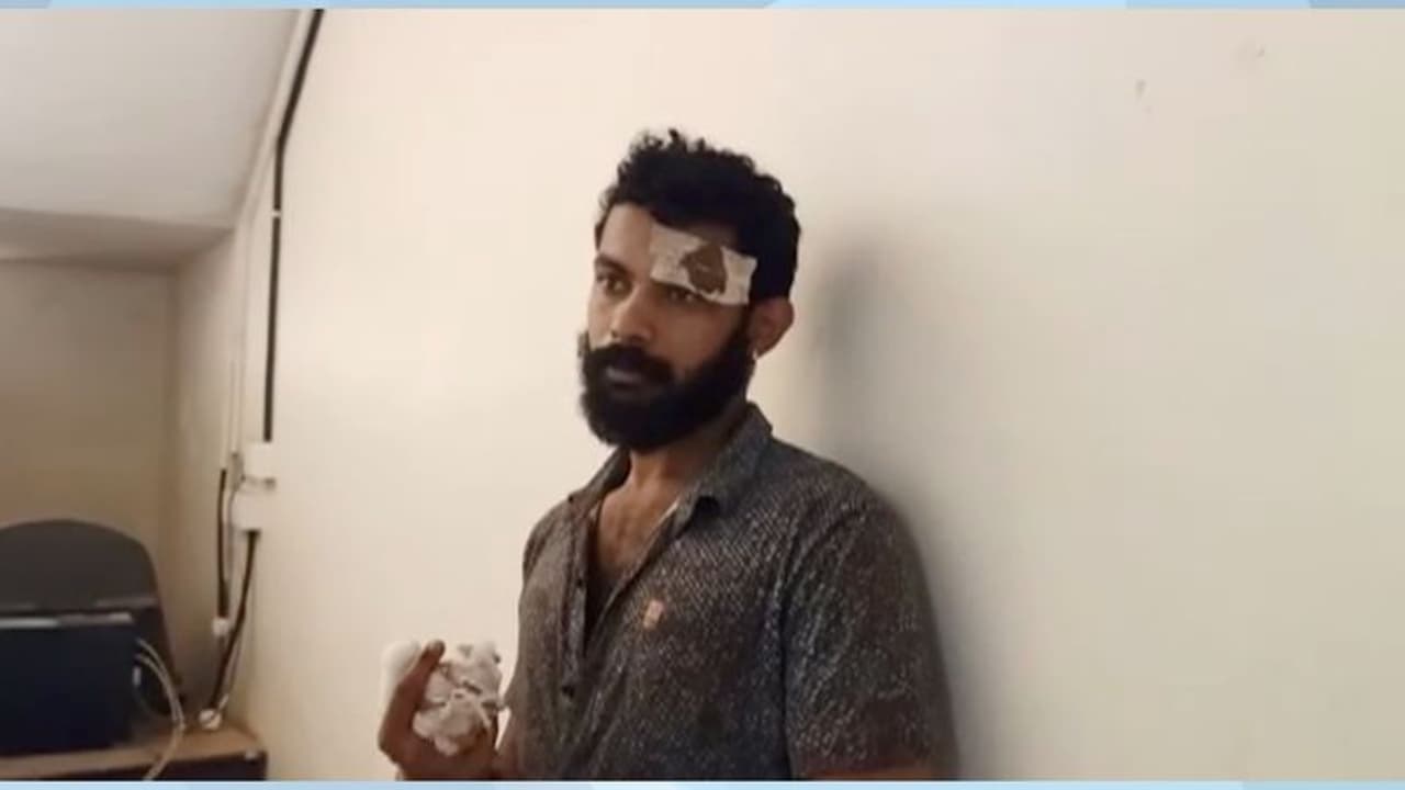 Father attacked : ലഹരിക്ക് അടിമകളായ സഹോദരങ്ങള് അച്ഛന്റെ തലക്ക് അടിച്ചു, ഗുരുതര പരിക്കുമായി അച്ഛൻ ഐസിയുവിൽ Father attacked : ലഹരിക്ക് അടിമകളായ സഹോദരങ്ങള് അച്ഛന്റെ തലക്ക് അടിച്ചു, ഗുരുതര പരിക്കുമായി അച്ഛൻ ഐസിയുവിൽ