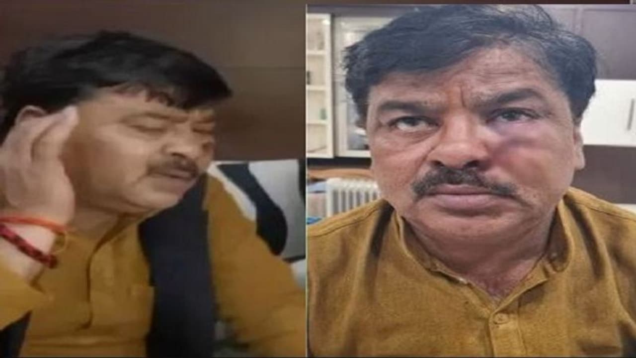 यूपी चुनाव के बीच हमले में घायल सपा विधायक का वीडियो आया सामने, कहा जान से मारना चाहते थे लोग यूपी चुनाव के बीच हमले में घायल सपा विधायक का वीडियो आया सामने, कहा जान से मारना चाहते थे लोग