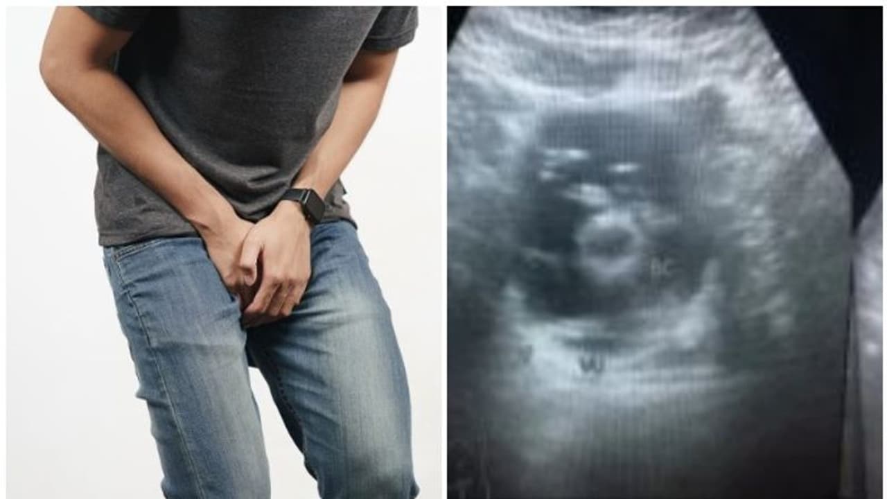 ലിം​ഗത്തിൽ കഠിനമായ വേദന, മൂത്രത്തിൽ രക്തം; ഡോക്ടർമാർ പരിശോധിച്ചപ്പോൾ ഞെട്ടി...