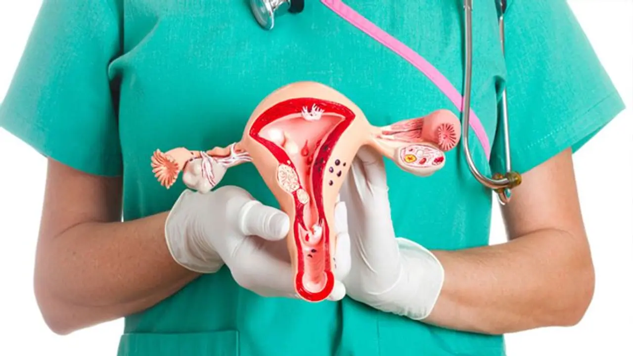 Ovarian Cancer : അണ്ഡാശയ അർബുദം ; ശ്രദ്ധിക്കാതെ പോകരുത് 5 ലക്ഷണങ്ങൾ