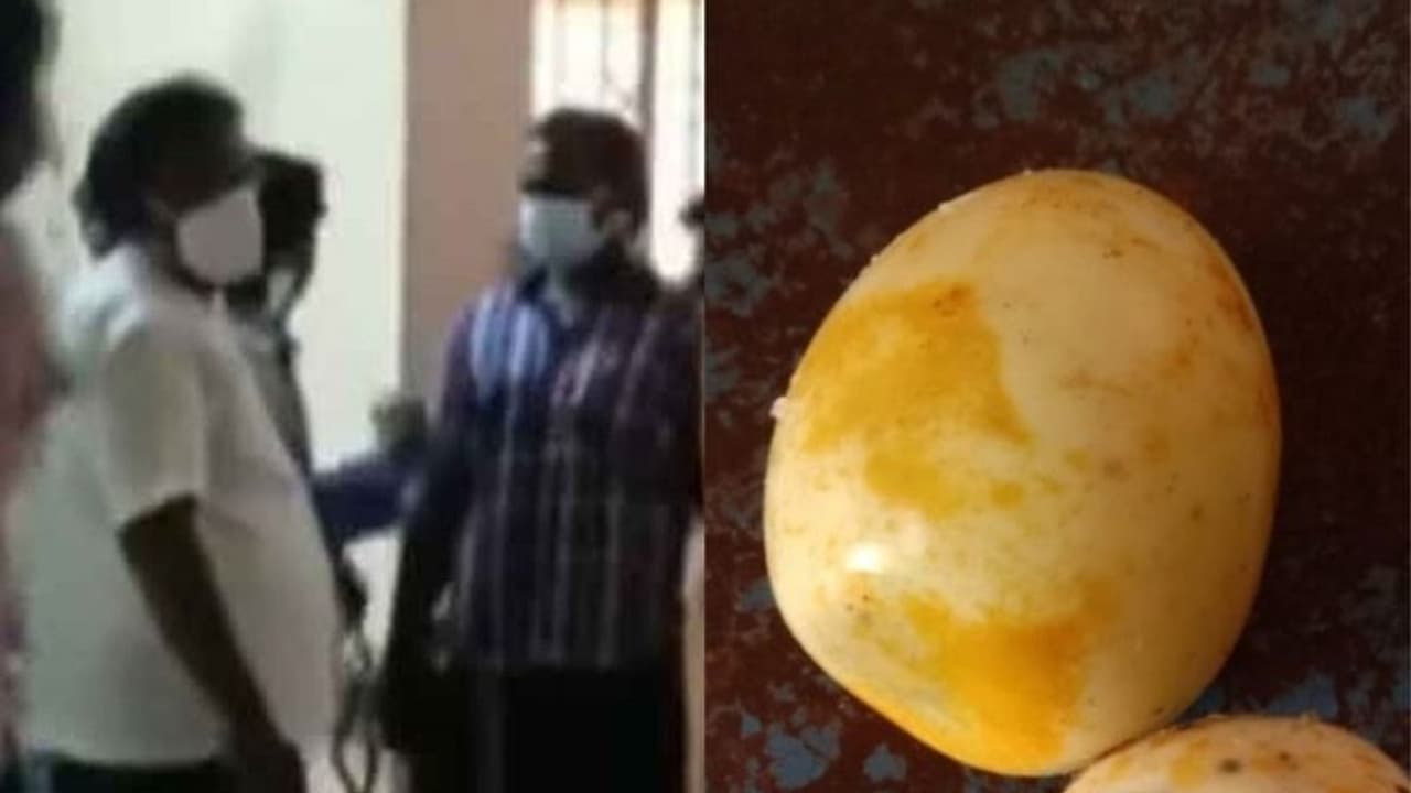 பரபரப்பு..!கெட்டுப்போன முட்டையை சாப்பிட்ட 20 குழந்தைகளுக்கு வாந்தி, மயக்கம்..மருத்துவமனையில் தீவிர சிகிச்சை