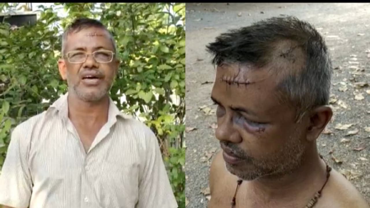 തൃശൂരില്‍ ഒരു കോടി ആവശ്യപ്പെട്ട് വ്യാപാരിക്ക് മര്‍ദ്ദനം, ഗുരുതര പരിക്ക്; ക്വട്ടേഷനെന്ന് സംശയം