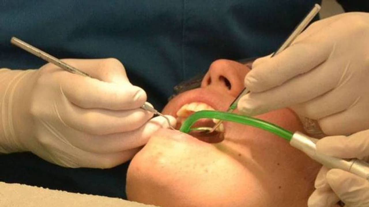 शॉकिंग: 10 साल के बच्चे के मुंह में थे 50 दांत: डॉक्टर भी देखकर रह गए हैरान, फिर यूं डॉक्टरों ने 30 उखाड़े शॉकिंग: 10 साल के बच्चे के मुंह में थे 50 दांत: डॉक्टर भी देखकर रह गए हैरान, फिर यूं डॉक्टरों ने 30 उखाड़े