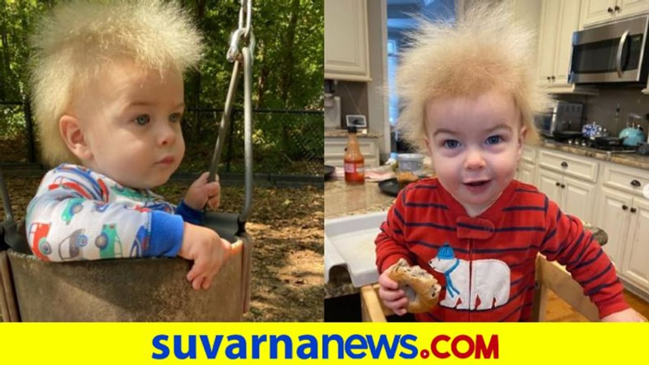 Uncombable Hair Syndrome: ತಲೆ ತುಂಬಾ ಕೆದರಿದ ಕೂದಲು, ಪುಟ್ಟ ಮಗುವನ್ನು ಕಾಡುತ್ತಿದೆ ವಿಚಿತ್ರ ರೋಗ