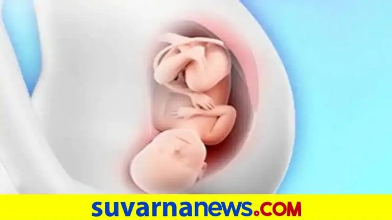 Medical Technology: ಗರ್ಭಾಶಯದ ಫೈಬ್ರಾಯ್ಡ್ ತೆಗೆಯಲು ಸರ್ಜರಿಗಿಂತ ಕೀಹೋಲ್ ಉತ್ತಮ: ಡಾ. ವಿದ್ಯಾ Medical Technology: ಗರ್ಭಾಶಯದ ಫೈಬ್ರಾಯ್ಡ್ ತೆಗೆಯಲು ಸರ್ಜರಿಗಿಂತ ಕೀಹೋಲ್ ಉತ್ತಮ: ಡಾ. ವಿದ್ಯಾ