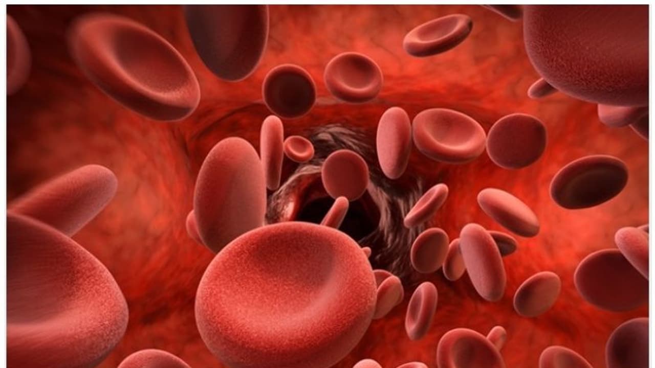 വിളർച്ച അകറ്റുന്നതിന് ഭക്ഷണത്തിൽ ശ്രദ്ധിക്കേണ്ട്...