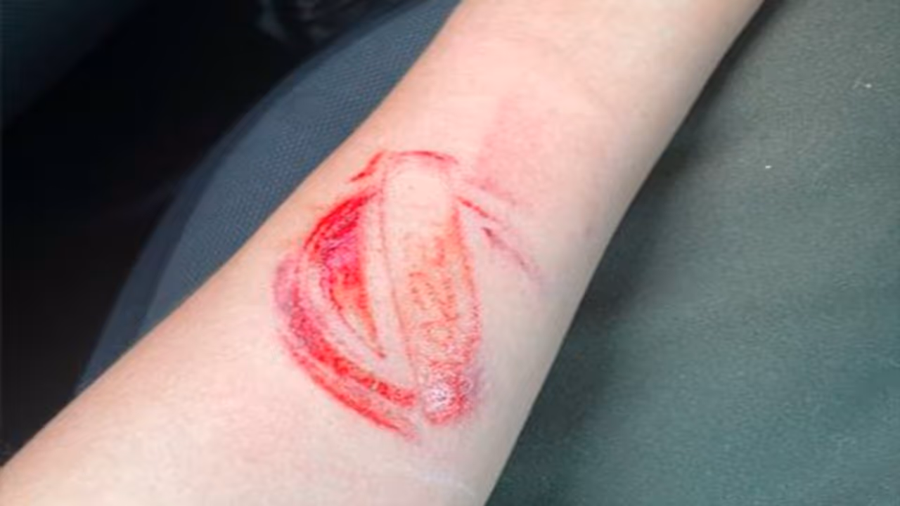 Airbag से बच जाती है जान, लेकिन छोड़ देता कंपनी के लोगो का निशान, देखें दिलचस्प मामले Airbag से बच जाती है जान, लेकिन छोड़ देता कंपनी के लोगो का निशान, देखें दिलचस्प मामले