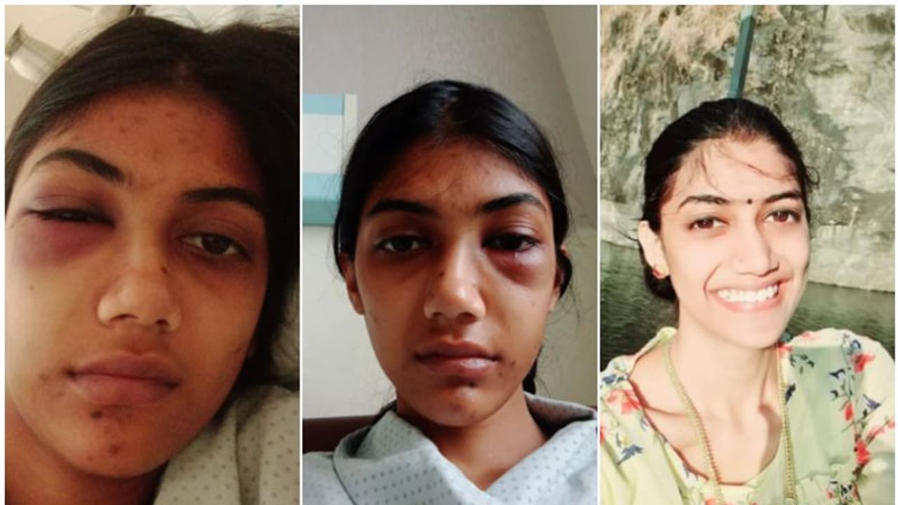 'അമ്മായി അമ്മയുടെ ആണ്സുഹൃത്തുമായുള്ള ബന്ധം കണ്ടുപിടിച്ചതിന് മര്ദ്ദനം'; പ്രതിയെ പൊക്കി പൊലീസ് 'അമ്മായി അമ്മയുടെ ആണ്സുഹൃത്തുമായുള്ള ബന്ധം കണ്ടുപിടിച്ചതിന് മര്ദ്ദനം'; പ്രതിയെ പൊക്കി പൊലീസ്