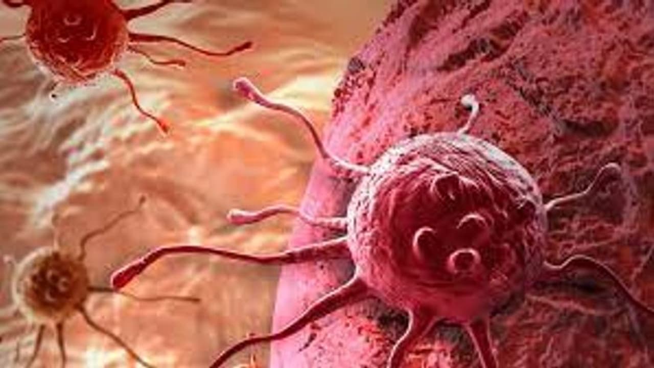 Childhood cancer Childhood cancer