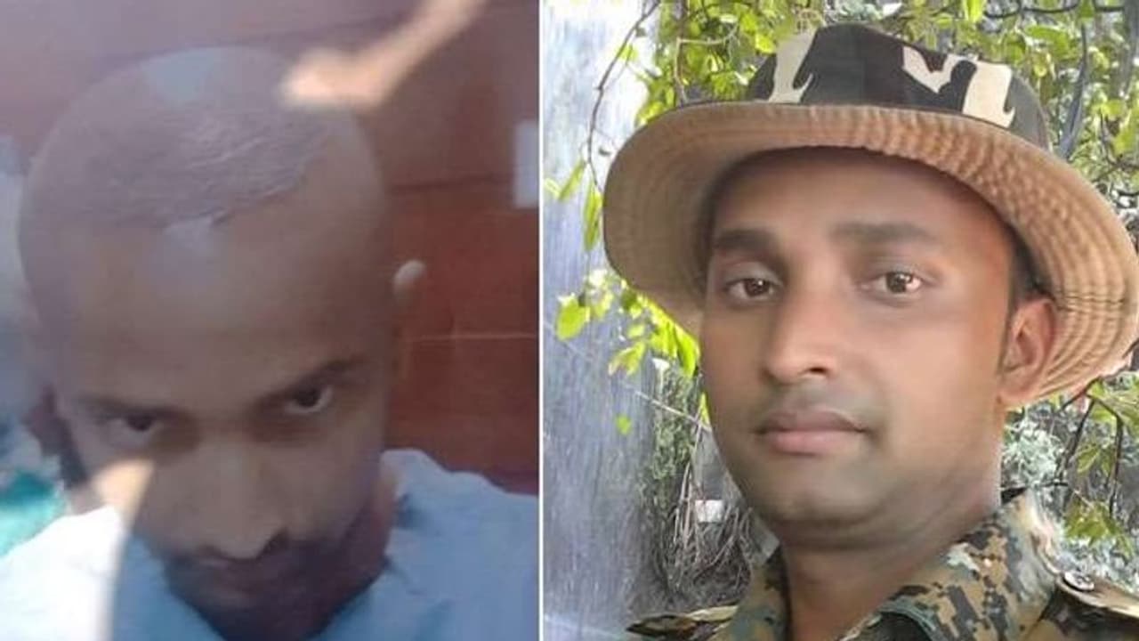 Patna ಮದುವೆ ತಯಾರಿಯಾಗಿ ಕೂದಲು ಕಸಿ ಮಾಡಿಕೊಂಡ, ಮರುದಿನವೇ ಸಾವು ಕಂಡ!