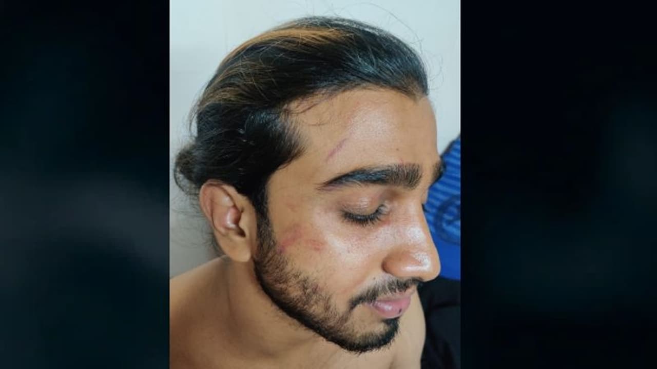 തൃശ്ശൂരിൽ ബിരുദ വിദ്യാർത്ഥിക്ക് റാഗിങ്ങിൻ്റെ പേരിൽ മർദ്ദനം തൃശ്ശൂരിൽ ബിരുദ വിദ്യാർത്ഥിക്ക് റാഗിങ്ങിൻ്റെ പേരിൽ മർദ്ദനം