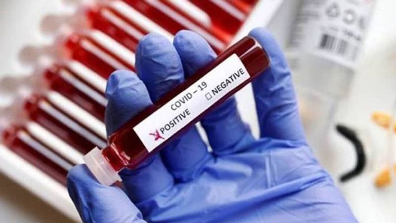 দিল্লির পর এই শহরেও কোভিড ১৯এর কালো ছায়ায়, দৈনিক আক্রান্তের সংখ্যা ভাঙল মার্চের রেকর্ড