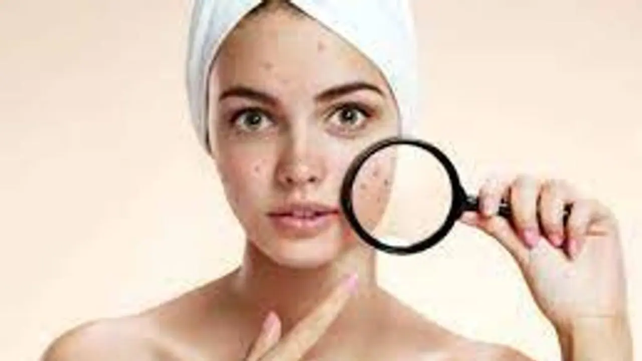 স্যালিসিলিক অ্যাসিড ত্বকের একাধিক সমস্যা মেটাবে এই একটা মাত্র উপাদান, ট্রাই করতে পারেন স্যালিসিলিক অ্যাসিড ত্বকের একাধিক সমস্যা মেটাবে এই একটা মাত্র উপাদান, ট্রাই করতে পারেন