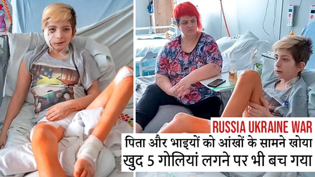 Russia Ukraine War:आंखों के सामने पिता को तड़पकर मरते देखा, खुद भी लगी 5 गोलियां, बच तो गया, मगर...
