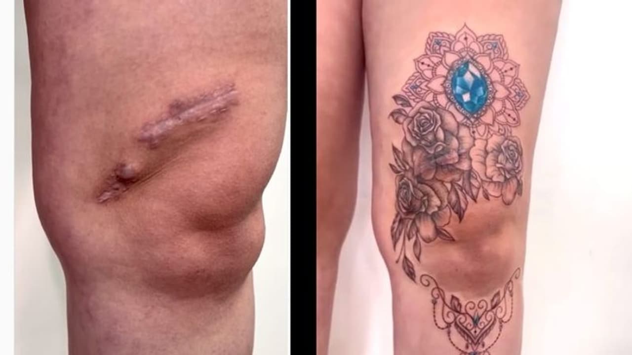 মহিলাদের অস্বস্তি ঢেকে দিচ্ছে ফুল আর প্রজাপতি, যাদু তুলি হাতে নিয়েছেন ব্রাজিলের ট্যাটু শিল্পি মহিলাদের অস্বস্তি ঢেকে দিচ্ছে ফুল আর প্রজাপতি, যাদু তুলি হাতে নিয়েছেন ব্রাজিলের ট্যাটু শিল্পি