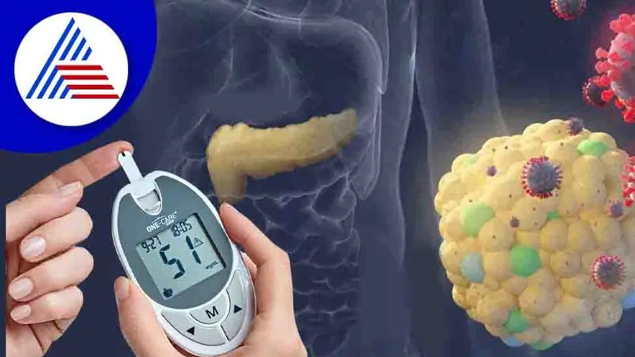 ಕೋವಿಡ್ ಸೋಂಕು ತಗುಲಿತ್ತಾ ? ಟೈಪ್ 2 ಮಧುಮೇಹದ ಅಪಾಯ ಹೆಚ್ಚಿದೆ ಹುಷಾರ್ ! ಕೋವಿಡ್ ಸೋಂಕು ತಗುಲಿತ್ತಾ ? ಟೈಪ್ 2 ಮಧುಮೇಹದ ಅಪಾಯ ಹೆಚ್ಚಿದೆ ಹುಷಾರ್ !