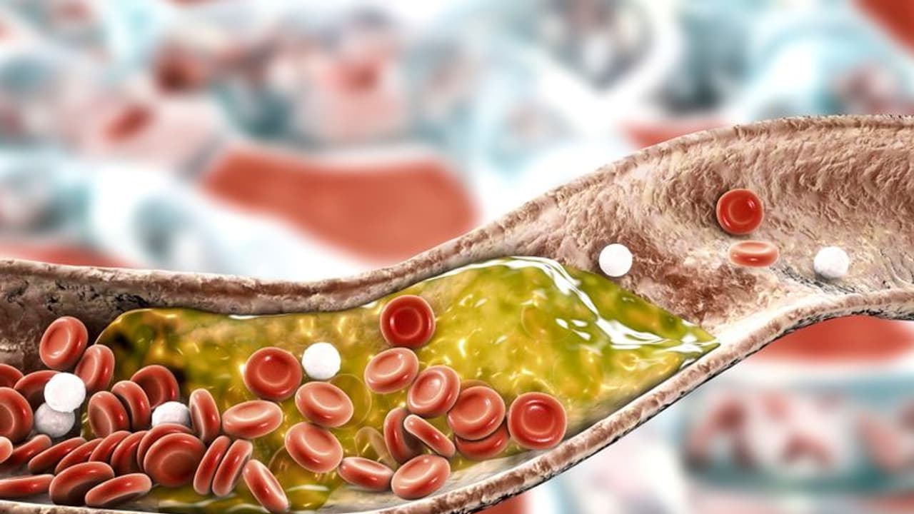 খারাপ নয় এভাবে শরীরে বাড়ান ভালো কোলেস্টেরল, বদলে ফেলুন এই অভ্যাসগুলো খারাপ নয় এভাবে শরীরে বাড়ান ভালো কোলেস্টেরল, বদলে ফেলুন এই অভ্যাসগুলো